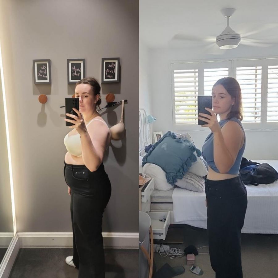 Fem Empire client before and after photos
